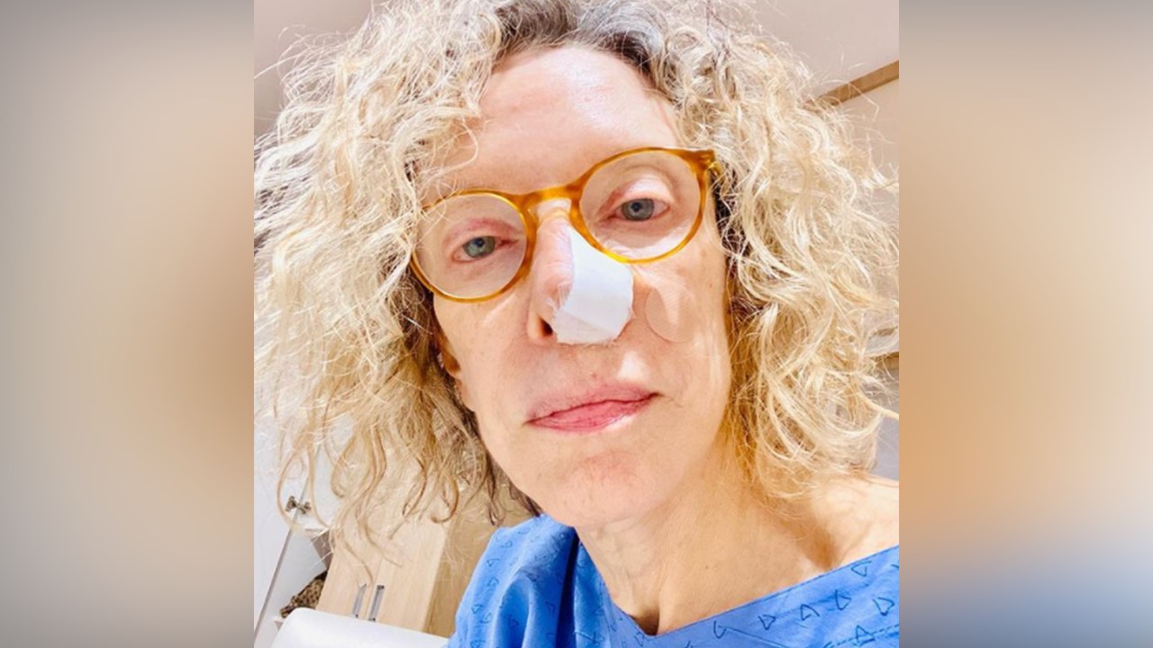 Marília Gabriela revela ter feito cirurgia para retirar câncer de pele do nariz